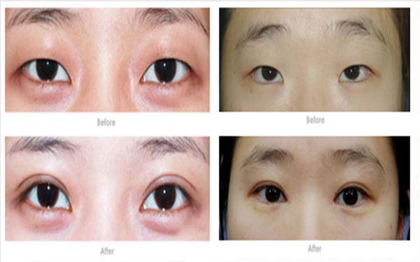 淮安有哪些口碑很好的整形醫(yī)院？前五排名來了！