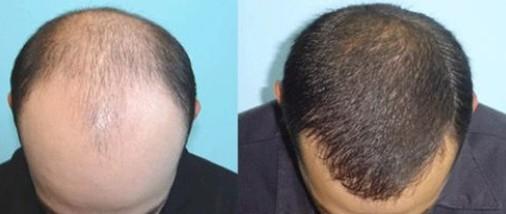 深圳哪家公立整形醫(yī)院好？本地人廣受推崇的前六名推薦