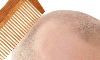 滄州市哪家醫(yī)院的隆鼻整形技術(shù)最實(shí)力？排行榜公布！