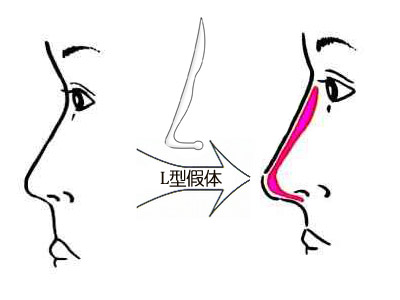 深圳最佳激光脫毛整形醫(yī)院推薦-公立醫(yī)院領跑市場！