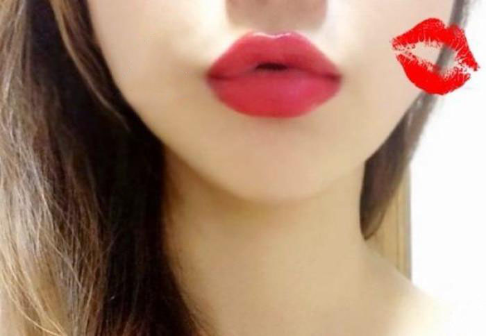 徐州改善眼角細(xì)紋醫(yī)生