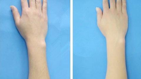 泰安斑點治療醫(yī)院排行榜：選擇這些醫(yī)院，讓斑點不再遮擋你的美麗~