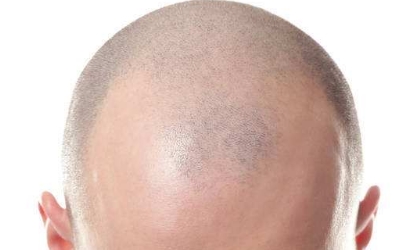 汕頭2023年微創(chuàng)整形醫(yī)院好評榜單前六名：伊麗莎白、華美、曙光脫穎而出！