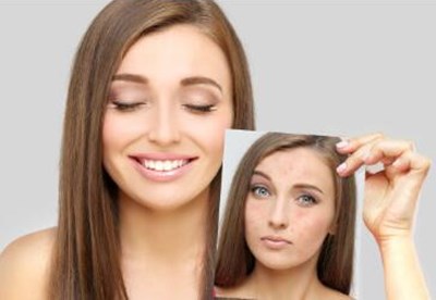 濰坊市雙眼皮整形怎樣選擇？人氣旺盛的三家醫(yī)院值得考慮！