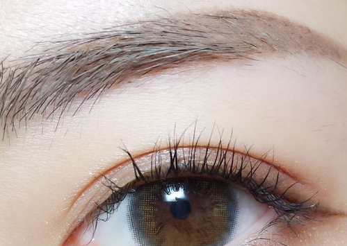 石家莊光子嫩膚對光老化醫(yī)生