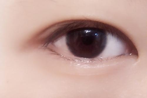 鄭州醫(yī)院雙眼皮手術(shù)五位知名醫(yī)生經(jīng)驗總結(jié)：單眼皮與眼袋治療最佳方案曝光