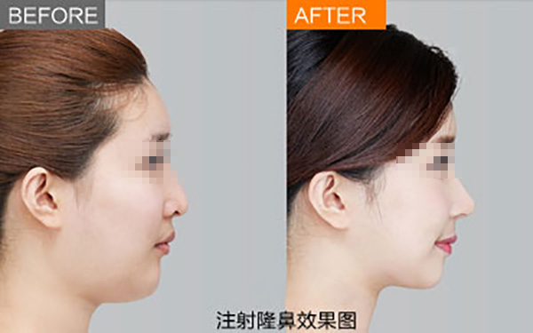 鄭州唇部整形醫(yī)院推薦：如何選擇合適的醫(yī)院？友友必看！