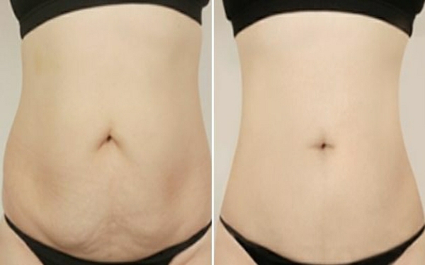 貴陽最受歡迎的雙眼皮手術(shù)機構(gòu)大揭秘，你一定不能錯過！