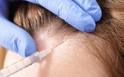 祛斑醫(yī)院推薦：打破斑點(diǎn)煩惱，找回美麗肌膚