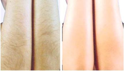 解放眼袋重害！揭秘成都頂尖醫(yī)療機(jī)構(gòu)眼袋技術(shù)