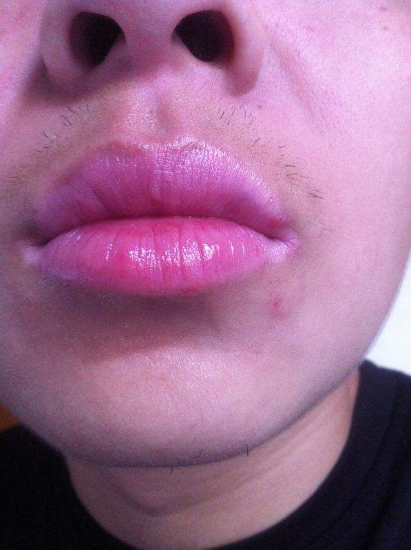 鞍山極速動(dòng)感無痕豐胸術(shù)醫(yī)生