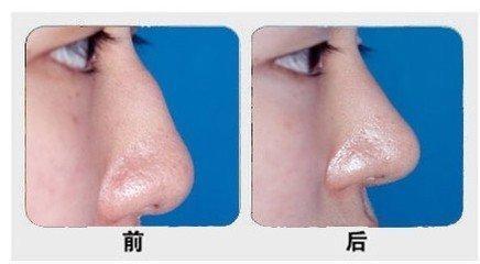 石家莊主要公立整形醫(yī)院排行榜！公辦醫(yī)療機構(gòu)最具實力！