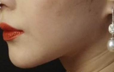 南寧1+N多效雙眼皮醫(yī)生