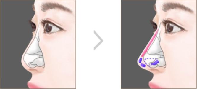 西安整形美容醫(yī)院推薦top4大揭秘！從西美到時光，最佳選擇一覽無余！