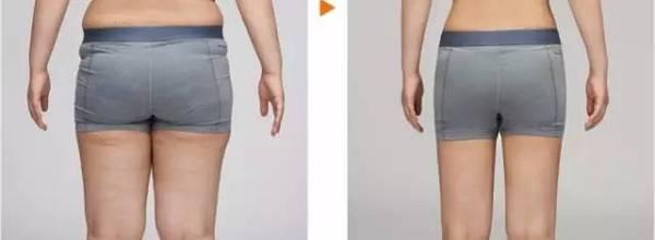 珠海頂級(jí)整容醫(yī)院推薦！價(jià)目表揭秘！