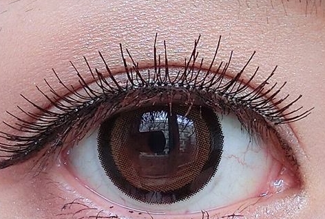 武漢鐳射激光祛抬頭紋醫(yī)生