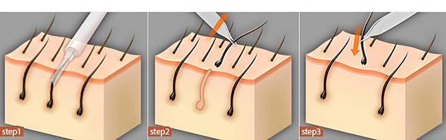 福州祛痣醫(yī)院推薦！快速了解前八家信譽(yù)口碑醫(yī)院