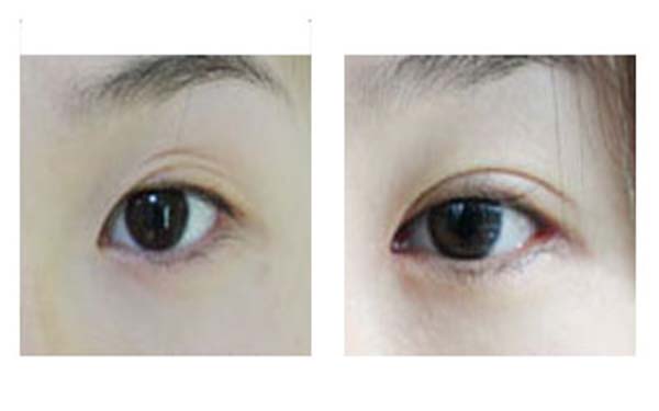 熱瑪吉整形醫(yī)院最受好評(píng)的六個(gè)機(jī)構(gòu)合集！尋找這些隱藏的寶藏醫(yī)院，分享給你，讓你重拾自信！