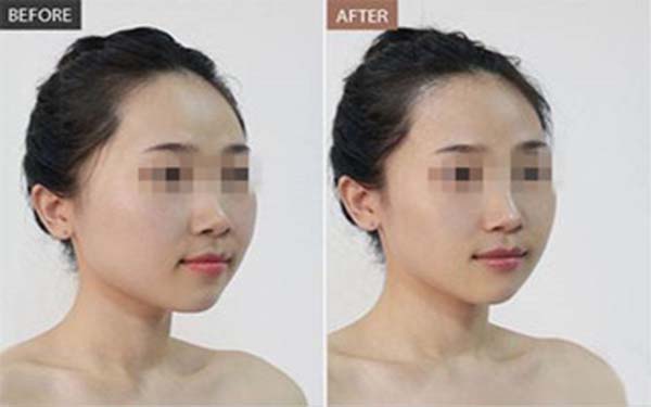 黃石市最好的雙眼皮醫(yī)院推薦TOP5，公私醫(yī)院評價大揭秘