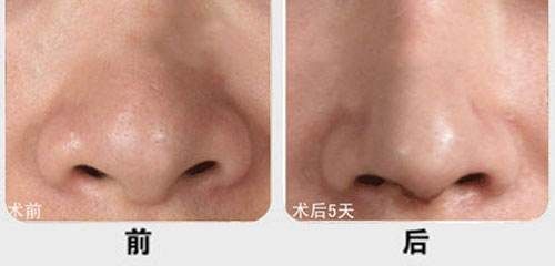 廈門市有哪些醫(yī)院提供優(yōu)質的脂肪填充服務？江頭醫(yī)院、臉康整形醫(yī)院、美麗醫(yī)療中心等值得一看！快來了解一下