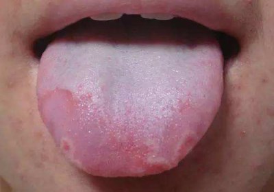 宜賓自體脂肪填充眼窩醫(yī)生