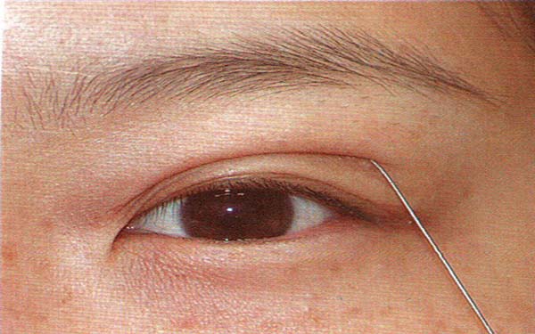 長(zhǎng)沙五家醫(yī)院哪家提供優(yōu)質(zhì)吸脂技術(shù)？推薦專(zhuān)業(yè)減重能手！