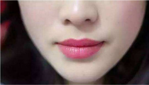 阜陽腹部除皺醫(yī)生