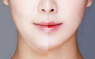 岳陽(yáng)大腿吸脂修復(fù)醫(yī)生