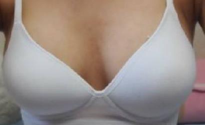 杭州晶塑去痘坑醫(yī)生