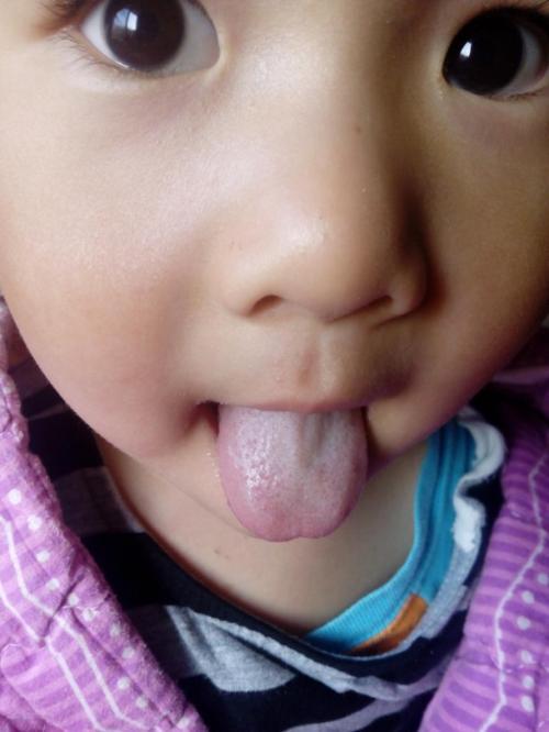 湛江玻尿酸聯(lián)合注射除皺抗衰醫(yī)生