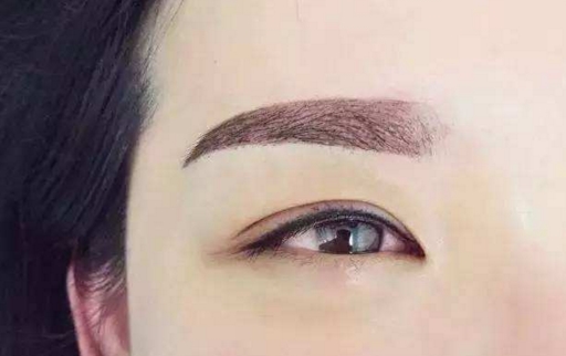 上海激光疤痕修復(fù)手術(shù)醫(yī)生