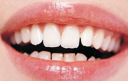 2023年，哪家醫(yī)院在武漢提供高質(zhì)量的無(wú)痕隆胸手術(shù)？