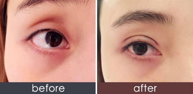 呼倫貝爾瑞藍除皺醫(yī)生