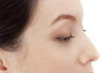 東莞透明質(zhì)酸面部填充醫(yī)生