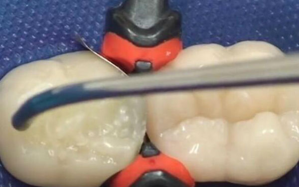 寧波下巴玻尿酸注射：2023年醫(yī)術精湛的醫(yī)院排行榜公布，這些整形醫(yī)院備受推崇！