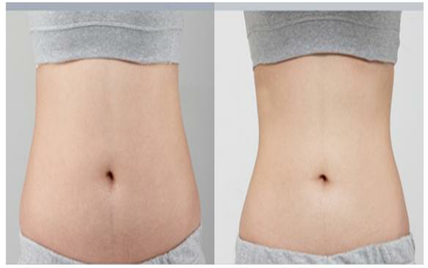 2023年貴陽哪家雙眼皮整形醫(yī)院口碑，排名前10強整容美容醫(yī)院全揭秘