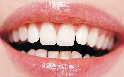 西安去頸部皺紋哪家醫(yī)院靠譜？2023西安提拉去頸部皺紋醫(yī)院十強榜單揭曉！