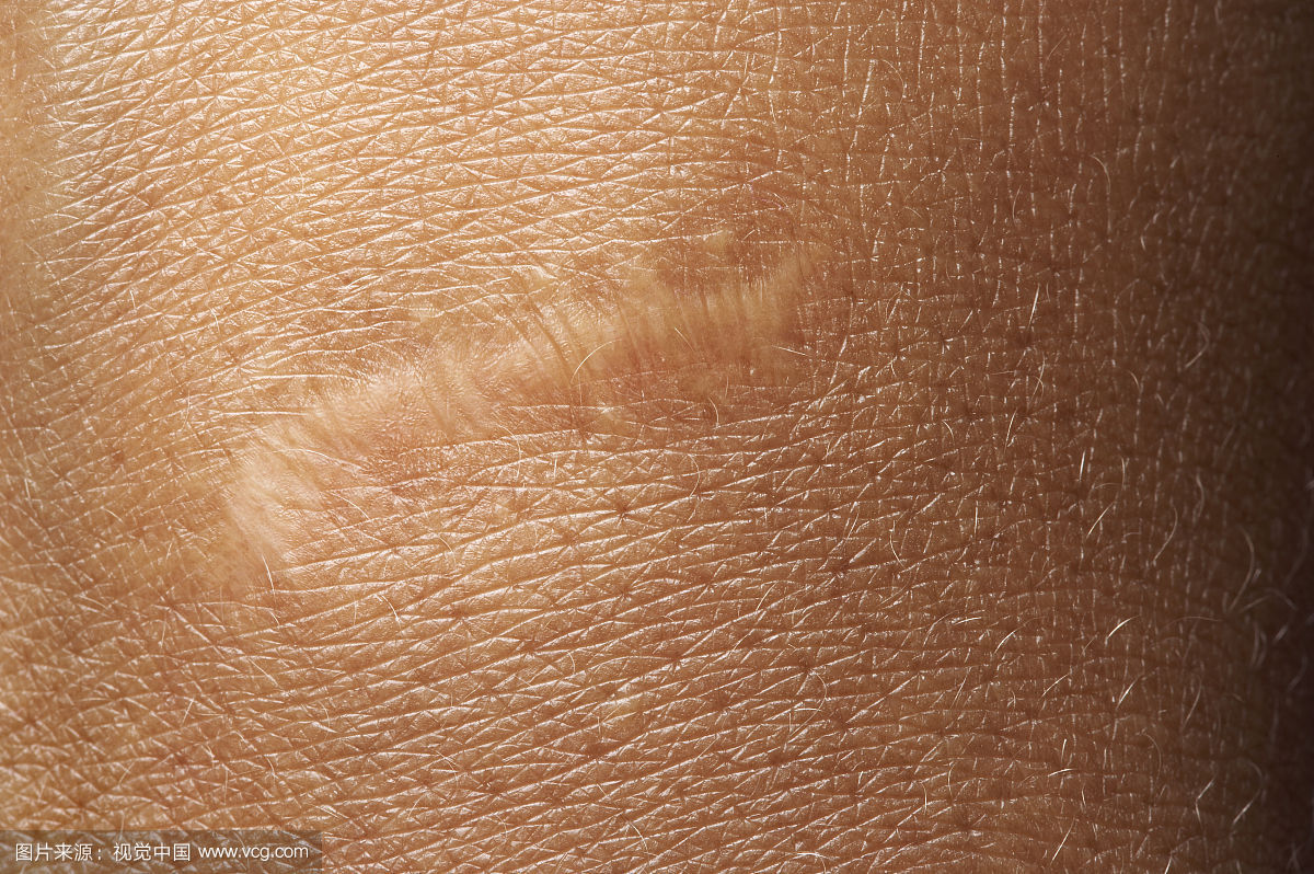 武漢微整頸紋醫(yī)生