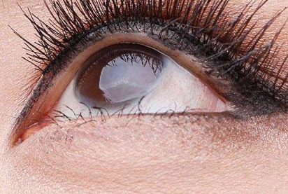 2023廣州肉毒素注射川字紋整形醫(yī)院排行榜公布！這些醫(yī)療美容機構備受矚目！