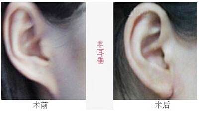 2023沈陽去魚尾紋雕塑醫(yī)院排行榜，這十家都備受口碑推崇！