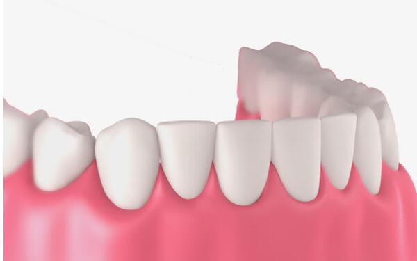 哪家南京整形醫(yī)院在川字紋脂肪填充方面效果突出？2023南京脂肪填充川字紋醫(yī)療前十強(qiáng)排行榜權(quán)威推薦！