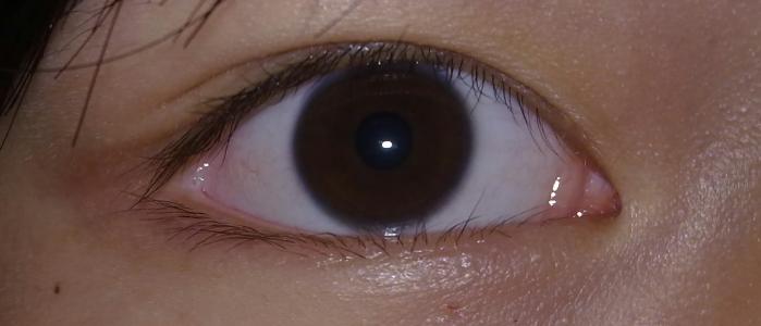 2023年浙江哪些醫(yī)院是值得去的提拉去眉間紋醫(yī)療美容醫(yī)院排名榜前十強詳解，實力解析！