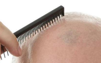 2023年度，沈陽整形美容醫(yī)院榜單公布！揭秘沈陽眾多醫(yī)院哪家豐下巴手術(shù)值得去