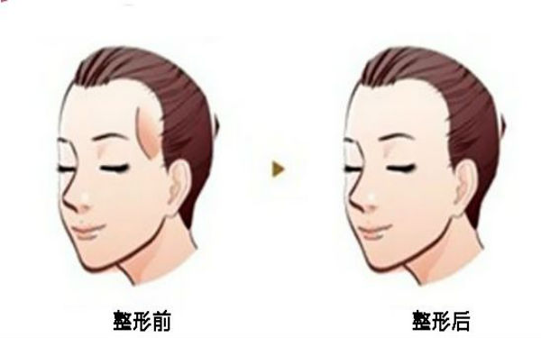 西寧顴骨矯正術(shù)：哪家醫(yī)院口碑好？2023年口碑排名前10的正規(guī)醫(yī)療整形醫(yī)院公布！