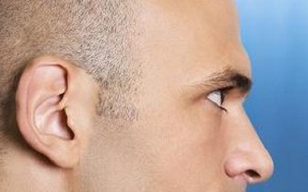 深圳哪幾家醫(yī)院能有效去除眼紋？2023年深圳比較好的眼紋去除醫(yī)院排名前十位解析！