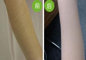 哪家南京雙眼皮手術(shù)醫(yī)院口碑好？2023年南京韓式雙眼皮手術(shù)前十名排序！