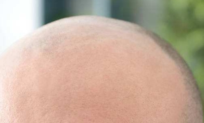 2023年鞍山比較推崇的激光法令紋整容醫(yī)院排名前十