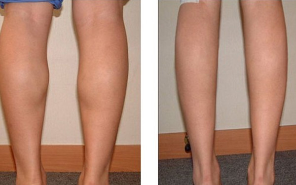 溫州面部奧美定：探尋2023年整形醫(yī)院排名！美容醫(yī)院揭曉，強(qiáng)烈熱推TOP10！