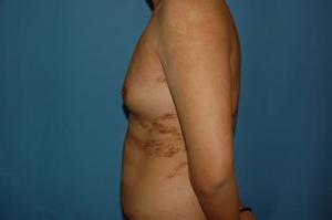 濟寧哪家醫(yī)院玻尿酸填充手術技術專業(yè)？2023年榜單首席整形醫(yī)院揭曉！