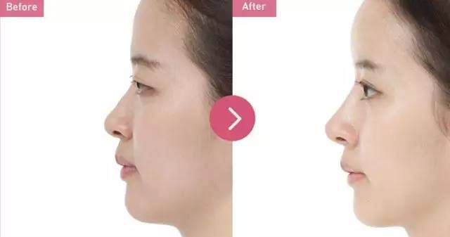 泰州眼紋打活細胞醫(yī)生